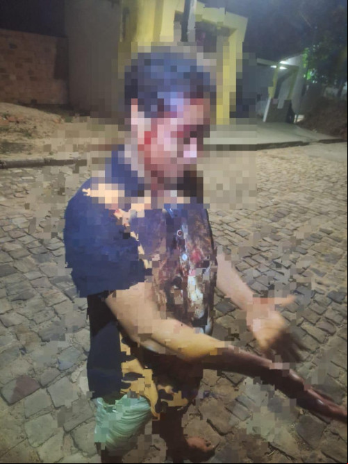 Mulher é espancada com cabo de vassoura pelo companheiro no interior do Piauí